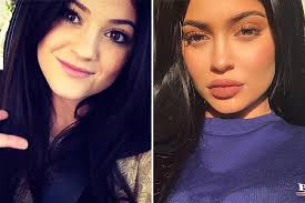 We cover images of kylie jenner before surgery alongwith the changes in kylie skin. Kylie Jenner Pregnant At 20 Inside Her Crazy Rise To Fame People Com