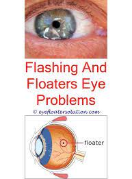 Eye Floaters Worse When Stressed Seeing Floaters In One Eye Silver In Eyes Floaters Floater With A Blur Floaters Eye Eye Floaters Causes Floaters And Flashes
