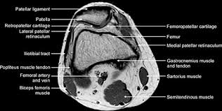 This webpage presents the anatomical structures found on knee mri. Jaypeedigital Ebook Reader