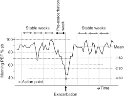 Early Detection Of Asthma Exacerbations By Using Action