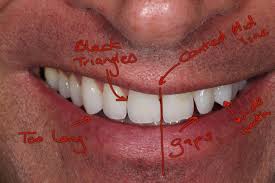 The Systematic Treatment Of A Canted Smile - Oral Health Group
