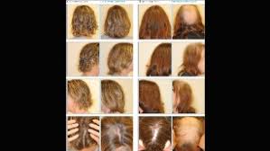 Hairmenstyles@gmail.com men's premium streetwear manchinni.com. How Some Women Avoid Hair Loss During Chemotherapy Cnn