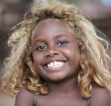 Belgian Canaries have the best hair ever!