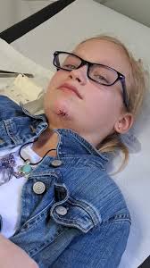 Y'all please pray for my Briana, she had a bicycle wreck at her dads  yesterday and her arm is broke (wrist) , she has road rash