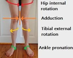 So let's say you just fought a guy, and you knocked him out. How To Fix Knee Valgus Updated 2020 Posture Direct