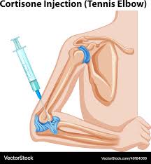 Image result for Elbow Injection