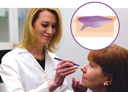 The most common skin cancers that are treated in this manner are basal cell and squamous cell carcinomas. Mohs Surgery The Skin Cancer Foundation