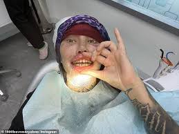Surgery-addicted star Mary Magdalene wants bigger implants to become 'a  stick with balloons' | Daily Mail Online