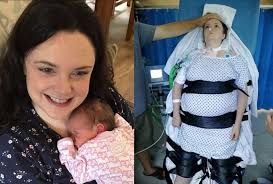 Gbs symptoms include muscle weakness, numbness, tingling, fatigue, pain, and gi issues. Guillain Barre Syndrome Locked In Paralysed And Unable To Communicate