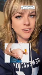 Signs and symptoms of T2D.