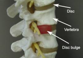 Upper Back Chest Pain Diagnosis Guide