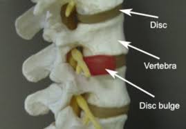Anatomy of the back how do you exercise your back? Upper Back Chest Pain Diagnosis Guide