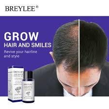 A study has found lavender oil and tea tree oil to be useful for reducing mild cases of hirsutism. Breylee Hair Growth Essential Oil 20ml Fast Powerful Hair Products Prevent Baldness Anti Hair Loss Shopee Brasil