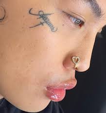 Hyaluron Pen Montpellier