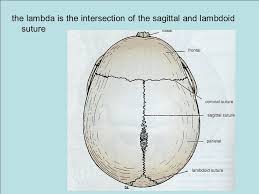 Diagram of mouse skull (not to scale). The Frontal Bone Consisting Of The Vertical Plate The Two Orbital Plates Ppt Download