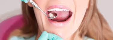 If you have multiple cavities that need to be filled, your dentist might decide to treat them over multiple visits. Cavity Fillings What To Expect Types Potential Problems