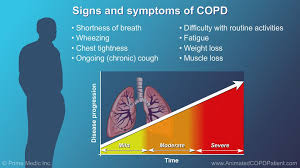 At First Copd May Cause No Symptoms Or Only Mild Symptoms As The Disease Progresses Common Symptoms Include Shortness Copd Copd Symptoms Shortness Of Breath