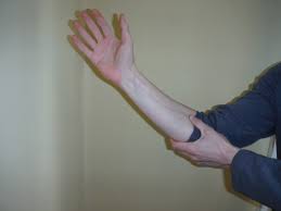 Cubital Tunnel Syndrome Sports Rehab Wellness