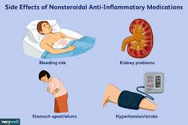 What Is The Best Anti Inflammatory Medication Nsaid