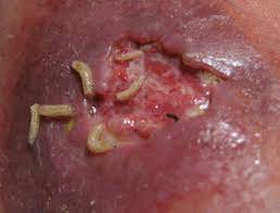 Maybe you would like to learn more about one of these? Maggots Quickly Clear Chronic Leg Ulcers Critical Care Hospimedica Com