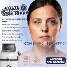 Janine Heck Estética