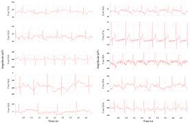 Electronics Free Full Text Arm Ecg Wireless Sensor