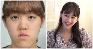2021 digital single forever 2020 single black mamba. Legendary Let Me In Star Heo Ye Eun Shares How Plastic Surgery Drastically Affected Her Life 8 Years Later Koreaboo