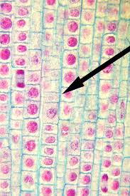 Interphase, which appears to the eye to be a resting stage between cell divisions, is actually a period of diverse activities. The Miracle Of Mitosis Cell Division Microscope It Out