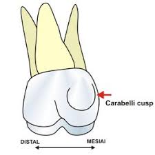 Mesiopalatal largest cusp distopalatal smallest cusp, almost spheroidal has a palatal pit at the end of the distopalatal groove there may be a cusp on the palatal surface of the mesiopalatal cusp. Cusp Of Carabelli Wikipedia