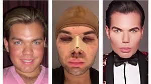 Jessica alves passa por mais uma cirurgia no nariz: Rodrigo Alves Makeover Plastic Surgery Youtube