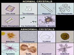 Types Of Crystals In Urine