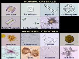 types of crystals in urine