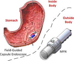 We did not find results for: Illustrative Operation Of The Proposed Field Guided Ce Inside The Human Download Scientific Diagram