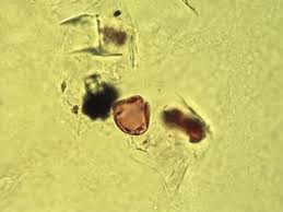 Image result for Scutia