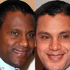 Black And White Skin Condition Model When Black Celebs Become White Beyonce Skin Black Celebrities Lighten Skin