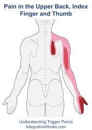 Trigger Points Pain In The Upper Back Index Finger And