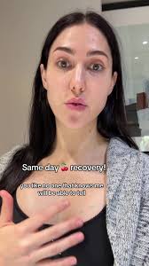 I got my 🍒 done today! I’m so grateful for all the TikTok’s I watched  before my surgery, so I hope I can contribute some insight too!!!