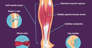 Pin On Health