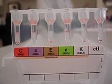 The card is then incubated for 15 minutes at 37° c followed by centrifugation. Blood Compatibility Testing Wikipedia