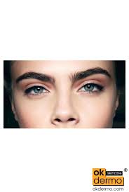 Bimat® Bimatoprost Ophthalmic Solution 0.03%