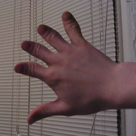 If thumbs are the most valuable and unique finger, why not have a hand full  of them? Give me one reason. - Imgur