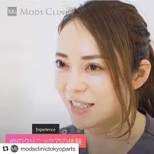 repost modsclinictokyoparts with get repost 脂肪吸引 注入なら モッズクリニック 頬 顎の 脂肪吸引のコツについてボァイエ先生に解説頂きました 顔の脂肪吸引と聞くと 数日顔が腫れてしまう と不安に思われている方が多いです 脂肪吸引 頬
