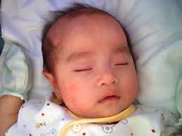 Maybe you would like to learn more about one of these? Artikel Berbahayakah Kuning Pada Bayi