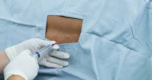 What You Need To Know About A Spinal Block Versus An Epidural According To Experts Epidural Spinal What Is Like