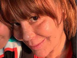 May 28, 2021 · alejandra guzmán ha sorprendido a sus fans al dejarse ver como pocas veces, en traje de baño, a sus 53 años, la rockera aún causa sensación luciendo prendas un tanto reveladoras y recientemente ha decidido compartir una imagen en la que luce un bikini, esto luego de haber perdido peso y tonificado su figura nuevamente gracias al ejercicio, la cantante no teme dejarse ver tal cual es y. Alejandra Guzman Antes De Sus Cirugias Asi Lucia Su Rostro
