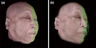 Superimposition of 3D reconstructed images from two different layers of... 