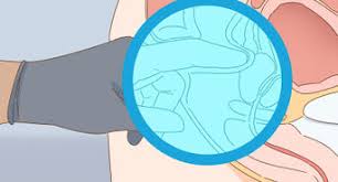 Ive seen several different nurses/aides do it both ways. 3 Ways To Insert A Nasal Cannula Wikihow