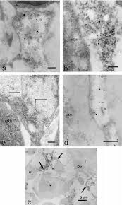 Long bones, especially the femur and tibia, are subjected to most of the load during daily activities and they are crucial for skeletal mobility. Electron Micrographs Of Rat Long Bone Sections After Immu Download Scientific Diagram