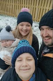 Tiny Scots baby with rare skull condition set for life-changing surgery to  reshape his head