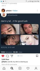 Look better & get healthier at the same time. 83 Glow Up Ideas Glo Up Transformation Body Body Motivation